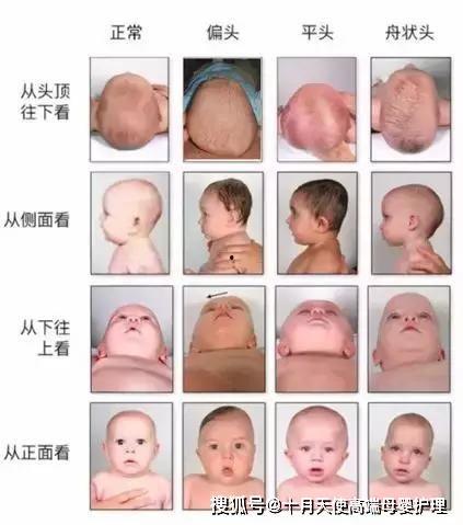 成人偏头矫正视频